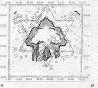 鄭賽抗震加固系統(tǒng)